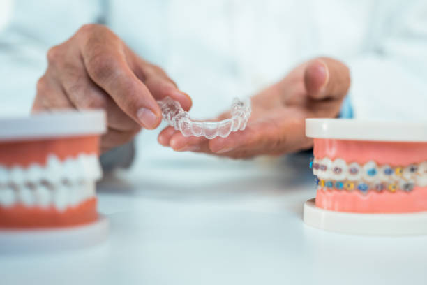 Invisalign in Waterloo: clear aligners cost, timeline and what to expect at Dental Lenses